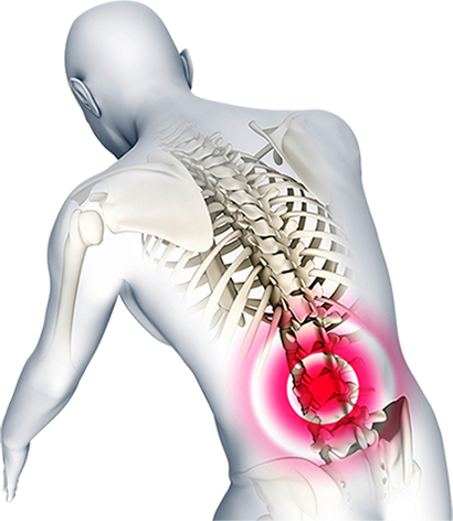 Spinal injury image