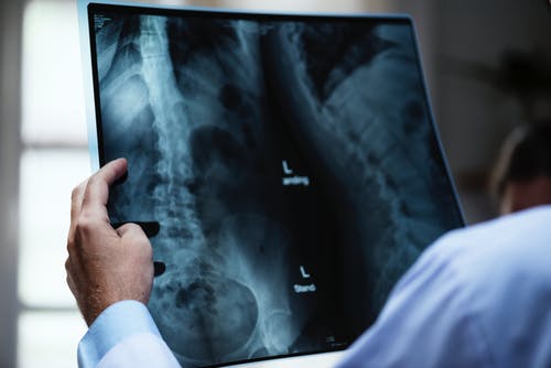 Doctor looking at a spinal xray